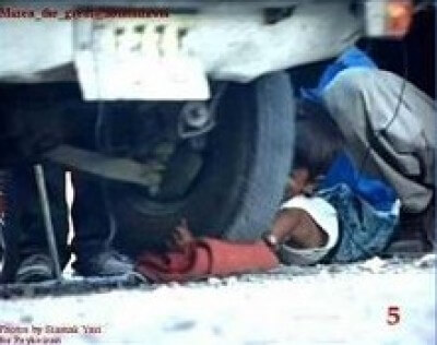 islam-punishment-boys-arm-5