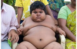 obese-child