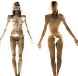 tsa-xray